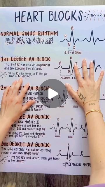 St Elevation Ekg, Cardiac Nurse Aesthetic, Ekg Technician Aesthetic, Cvicu Nursing, Ekg Nursing, Cvicu Nurse, Cardiac Rehab, Emt Study, Paramedic Student