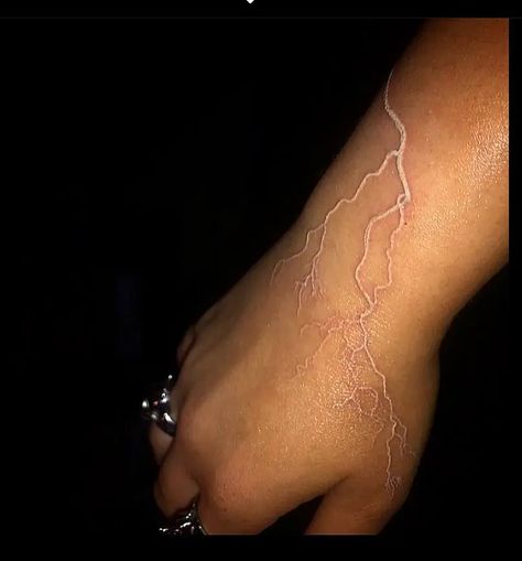 White Veins Tattoo, White Tattoos Lightning, White Ink On Brown Skin, Lighting Tattoo White Ink, White Ink Scar Tattoo, White Ink Lightning Tattoo Hand, White Lightning Tattoo Shoulder, Brown Ink Hand Tattoo, White Ink Black Skin