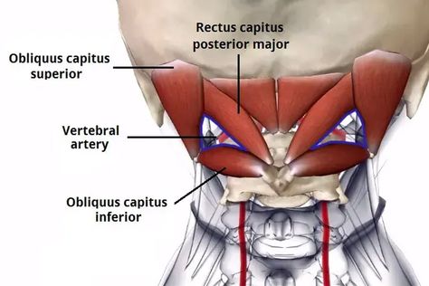 The Ultimate Guide to the Suboccipital Muscles - Iron Neck Suboccipital Muscles, Neck Muscle Anatomy, Anatomy Pictures, Severe Neck Pain, Whiplash Injury, Head Muscles, Occipital Neuralgia, Vertebral Artery, Muscle Stretches