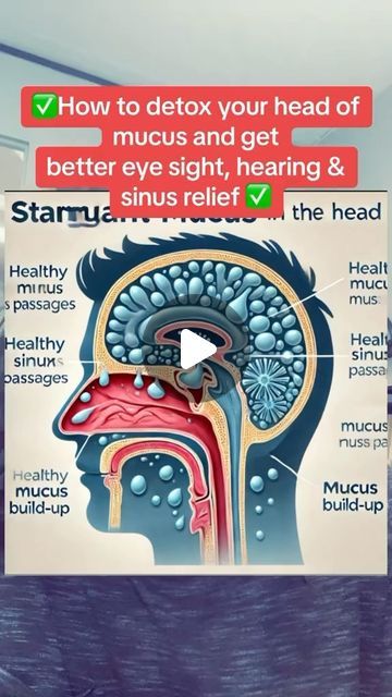 Raw (Mourab) Maraby on Instagram: "✅How to detox your head of mucus and get better eye sight hearing & sinuses✅  #sinusrelief #mucusremoval #mucus" Mucus Causing Foods, Getting Rid Of Mucus, Sinus Remedies, Natural Remedies For Allergies, Eye Sight, Sinus Relief, Sinus Infection, Health Recipes, Best Fruits