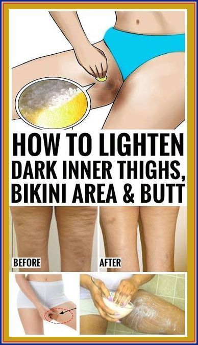 How To Lighten Dark Inner Thighs Naturally Dark Inner Thighs, Tiny Shorts, Health Tips For Women, Micro Mini Skirt, Inner Thigh, Health Check, Micro Mini, Health Facts, Mens Health