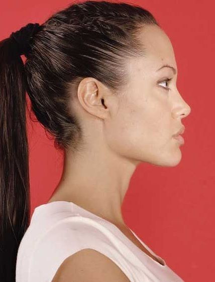 Angelina Side Profile, Rhinoplasty Side Profile, Angelina Jolie Dark Hair, Angelina Jolie Side Profile, Angelina Jolie Jawline, Chin Side Profile, Angelina Jolie Profile, Nose Front Profile, Side Profile Jawline