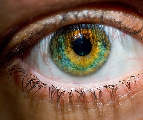 Sunflower eye...amazing!! Sunflower Eyes, Eye Color Facts, Pretty Eyes Color, Eye Iris, Iris Eye, Rare Eyes, Amazing Eyes, Beautiful Eyes Color, Lenses Eye