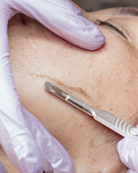 Smooth skin, sharp results - experience the brilliance of dermaplaning ✨️😍  #FacialNearMe #GlowingSkin #SkinHealth #JoannaVargas #HappyInYourSkin Dermaplaning Aesthetic, Esthetician Ideas, Dermaplane Facial, Dermaplaning Facial, Facial Esthetics, Esthetician Inspiration, Spa Photos, Medical Aesthetician, Joanna Vargas