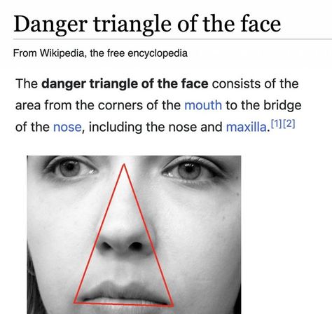 The danger triangle of the face consists of the area from the corners of the mouth to the bridge of the nose, including the nose and maxilla. Due to the special nature of the blood supply to the human nose and surrounding area, it is possible, albeit extremely unlikely, for retrograde infection from the nasal area to spread to the brain, causing cavernous sinus thrombosis, meningitis or brain abscess. Human Nose, Triangle Nose, Health Signs, Nose Shapes, Learn Yoga, Lack Of Energy, Sinus Infection, Migraine Headaches, Adrenal Fatigue