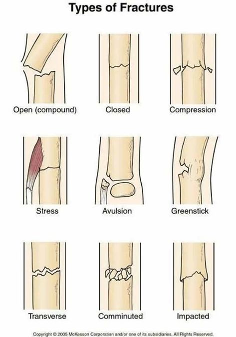 Vet Nursing, Nursing Things, Vet Nurse, Surgical Technologist, Medical Student Study, Nursing School Survival, Nursing School Studying, Medical Facts, Nursing School Tips