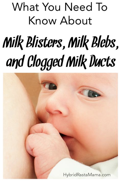 Do you have pain and soreness as a result of breastfeeding? Noticing some blister-like pimples on your nipples? Learn everything you need to know about milk blebs, milk blisters, and clogged milk ducts   how to get relief naturally from HybridRastaMama.com. She's had them ALL!! #milkblebs #nippleblisters #milkblisters #cloggedmilkducts #pluggedducts #mothersmilk #breastfeeding #sorebreasts Clogged Milk Duct Remedies, Milk Duct Clog, Milk Blister, Clogged Milk Duct, How To Heal Blisters, Blood Blister, Clogged Duct, Holistic Pet Care, Mother Milk