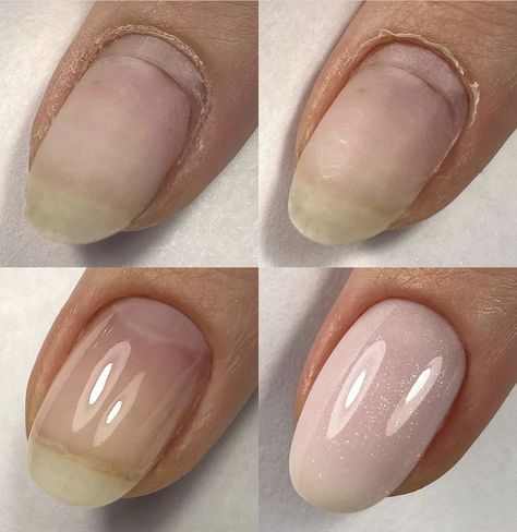 Structure Manicure, Nail Picking, Gel Toe Nails, Gel Toes, Instagram Collage, Iphone Case Stickers, Cuticle Remover, Nail Art Instagram, Instagram Nails