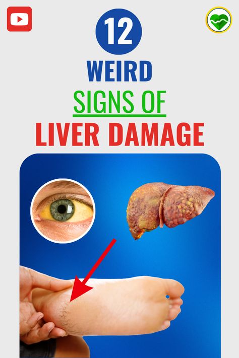 Are you experiencing unexplained fatigue, abdominal pain, or sudden weight loss? These could be subtle signs of liver damage lurking beneath the surface. Understanding these mysterious signals is crucial for early detection and liver health. #liver #health #liverhealth #liverdamage #liverdisease #liverdetox #wellness #healthtips #disease #healthandwellness Signs Of Liver Damage, Weird Signs, Liver Detox Recipes, Liver Damage, Liver Detox, Healthy Liver, Natural Therapy, Liver Health, Beneath The Surface