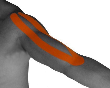 kinesiotaping for biceps tendonitis K Tape, Muscle Building Women, Rotator Cuff Injury, Kinesio Tape, Kt Tape, Softball Stuff, Kinesio Taping, Ab Workout Men, Tight Hip Flexors