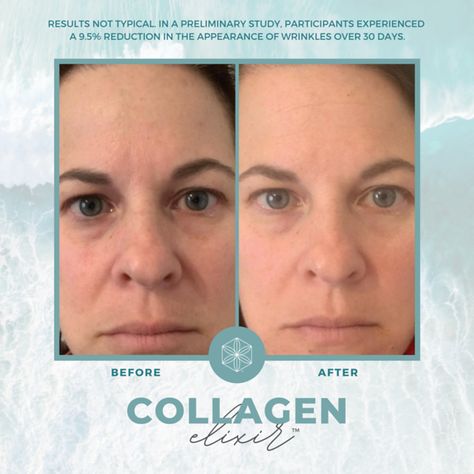 Before and After Images and Templates - Isagenix Collagen Elixir, Nail Vitamins, Vitamin C And Zinc, Erase Wrinkles, Marine Collagen, Ancient Beauty, Isagenix, Collagen Peptides, Goji Berries