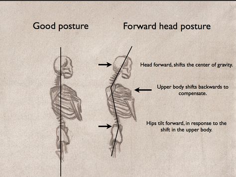 Great diagram showing forward head posture Help With Posture, New Dances, Forward Head Posture Exercises, Posture Fix, Stand Up Straight, Text Neck, Neck And Shoulder Muscles, Feel Better Soon, Forward Head Posture