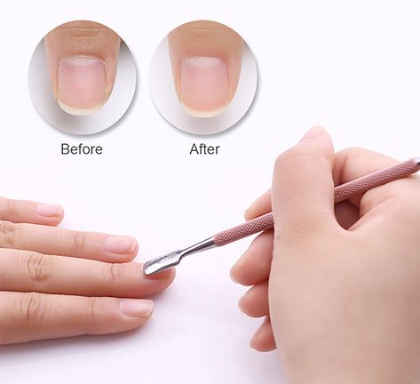 MUST have 1pc Stainless Steel Cuticle Remover/ Double Sided Finger Dead Skin Push - Pusher Cuticle Nail Pusher, Nail Glue Remover, Nails Care, Polymer Clay Miniature, How To Remove Glue, Remove Acrylic Nails, Nail Techniques, Cuticle Care, Colorful Nail Art