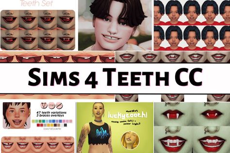 Sims 4 Teeth Cc, Sims 4 Romance Mods, Sims 4 Cc Teeth, Traditional Braces, Sims 4 Male Clothes, Sims 4 Black Hair, Gaming Ideas, Brace Face, Gap Teeth