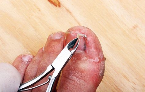 The Right Way to Clip Your Toenails Pretty Nails Glitter, Ingrown Toenail, Nail Design Video, Pretty Nail Colors, Ingrown Toe Nail, Pretty Nail Designs, Nail Art Videos, Dark Nails, Pretty Nail Art