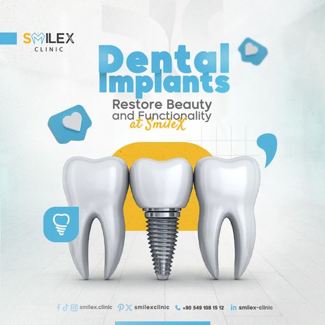 💪Dental Implants, Restore Beauty and Functionality at SmileX.  💪 Whether you're dealing with tooth loss due to injury or decay, dental implants are the optimal solution to regain a bright smile and efficient functions.  📞Schedule your appointment today you deserve the best.  ⚪ISTANBUL TÜRKÌYE  https://wa.me/905491081512⁠ ⁠ #orthodontics #straightteeth #veneers⁠ #tooth #dentalimplants #teethwhitening ⁠ #dentist #dental #dentistry #teeth⁠ #İstanbul #türkiye Dental Implant Poster, Dental Implants Creative Ads, Dental Campaign, Dental Content, Dental Post, Relax Photo, Composite Fillings, Dental Composite, Dental Advertising