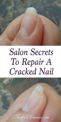 Shared from a nail tech, these salon secrets to repair a cracked nail are tried and true tips and techniques that you can use at home. There’s no need to head to the salon because you can DIY! Cracked Nails, Broken Nails, Nail Repair, Nail Care Tips, Hair Hoco, How To Grow Nails, Homecoming Hair, Can Diy, Nail Health