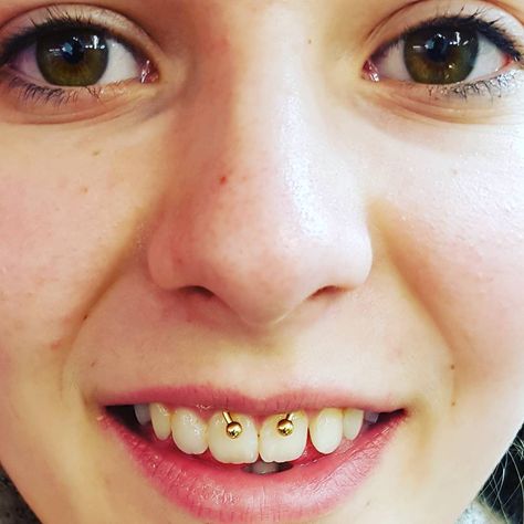 Marc Stingl Piercing Vienna on Instagram: “Lippenband Piercing in Gold #smileypiercing #smile #lippenband #smiley #piercings #pierced #piercing #girlswithpiercings #piercedgirls…” Gold Smiley Piercing, Piercings Smiley, Gold Piercings, Smiley Piercing, Piercings For Girls, Hoop Ring, Nostril Hoop Ring, Vienna, Smiley