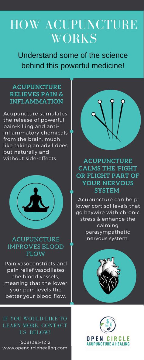 How Acupuncture Works, Benefits Of Acupuncture, Acupuncture Benefits Facts, Acupuncture Aesthetic, Acupuncture Quotes, Acupuncture Office, Meridian System, Acupuncture Mat, Acupuncture Charts