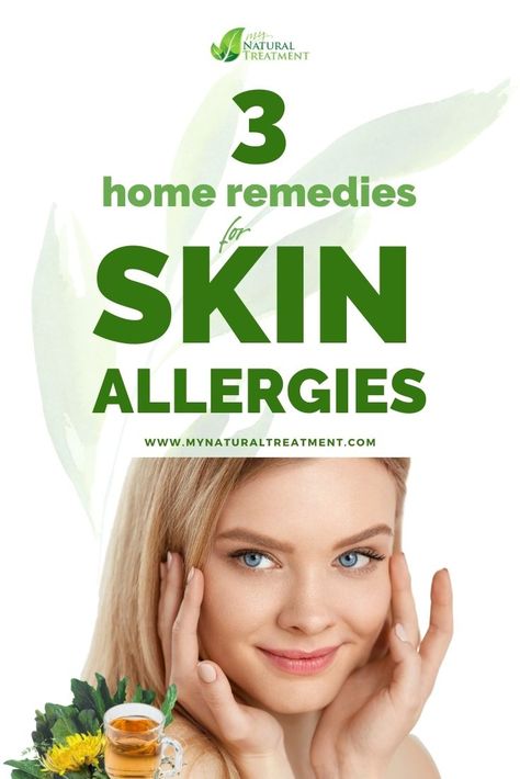 3 Powerful Home Remedies for Skin Allergies (Rashes) Face Allergy Remedies Skin Care, Skin Allergy Pictures, Skin Allergy Remedies, Home Remedies For Rashes, Rash Remedies, Home Remedy For Boils, Home Remedies For Face, Allergy Rash, Dishwasher Cabinet