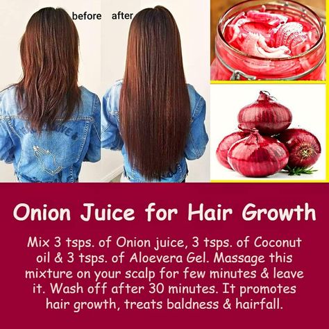 For Hair Growth Tips, Hair Oil Massage, Onion Juice For Hair Growth, Juice For Hair Growth, Juice For Hair, Onion Benefits, Hair Oil For Hair Growth, Onion Hair Oil, Onion Juice For Hair