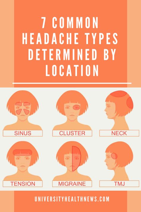 Headache is the most common form of pain. Although there are over 150 types of headache, only a few types are common. The location of your headache can help you know the type. « Previous Headache Location Meaning, Headache Meaning, Headache Location, Tension Migraine, Headache Types, Natural Headache Remedies, Health And Fitness Magazine, Tension Headache, Healthy Diet Tips