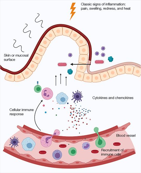 Inflammation | Bio-Rad Adaptive Immune System, Get Thick, Signs Of Inflammation, Systemic Inflammation, C Reactive Protein, Cells And Tissues, Ketosis Diet, Viral Infection, Nerdy Things