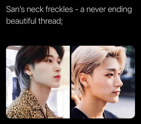 San Neck Freckles, San Freckles, Ateez San, Beautiful Things, Quick Saves