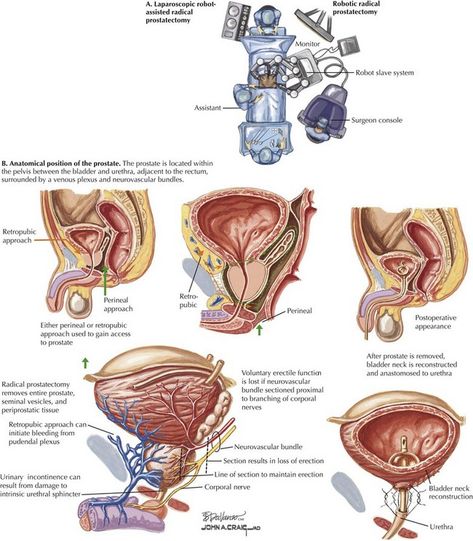 Prostate Awareness Month, Respritory System Diagram, Lumbar Spine Xray Anatomy, Prostate Surgery, Medical Diagrams Vintage, Infratemporal Fossa Anatomy, Pa Life, Man Anatomy, Surgical Tech