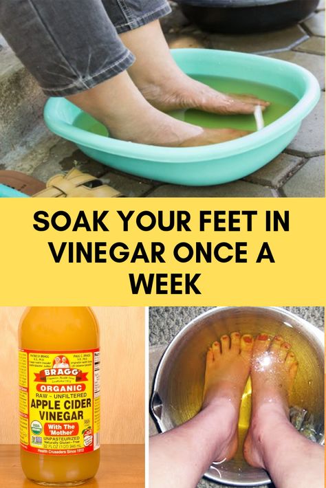 Soak Your Feet in Vinegar Once a Week Apple Cider Vinegar Feet Soak, Dry Feet Remedies Foot Soaks, Soften Feet Overnight, Smelly Feet Remedies, Cracked Feet Remedies, Vinegar Foot Soak, Dry Feet Remedies, Male Hygiene, Apple Cider Vinegar Foot Soak