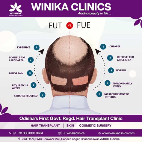 Follicular Unit Transplantation Fue Hair Transplant, Best Hair Transplant, Hair Transplant, Hair Restoration, Hair Quality, Hair Follicle, Cosmetic Surgery, Creative Ads, How To Stay Healthy