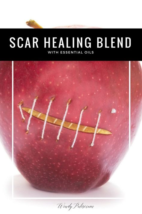 Scar Healing, Coldsore Remedies Quick, Oils For Scars, Essential Oils For Colds, Essential Oils For Headaches, Skin Natural Remedies, Frankincense Myrrh, Cold Sores Remedies, Natural Sleep Remedies