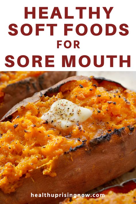 What are the best nutrition-rich soft foods for sore mouth? If you're looking for a pemphigus vulgaris diet or an ulcer diet, this list of 12 nutritious foods is a good place to start. This healthy soft foods diet is good for anyone with oral blisters or mouth sores who is looking for soft foods that won't scratch or jab or inflamed tissue, giving the mouth a chance to heal. Easy food for sore mouth | Food for sore mouth |  Best foods for sore mouth Soft Foods For Dental Work Easy Recipes, Soft Food For Sore Throat, Healthy Soft Food Diet, Soft Foods For Sore Throat, Soft Food Diet Ideas, Soft Food Snacks, Soft Healthy Foods, No Chew Foods, Soft Foods For Dental Work