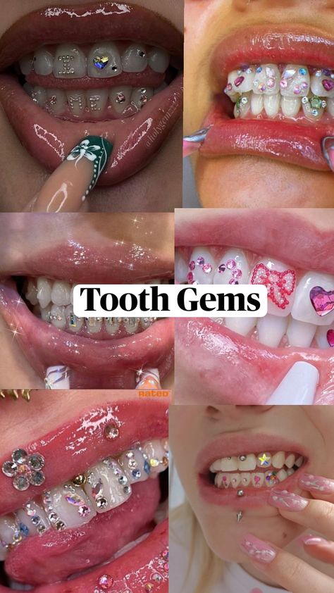 #toothgems #jewlery #pintrest #tooth #jems #cute #bling #charms #toothgemkit #Gold#silver #design Pretty Teeth, Dental Jewelry, Grillz Teeth, Getting Braces, Charm Bracelets For Girls, Cute Braces, Diamond Teeth, Tooth Charm, Cute Tooth