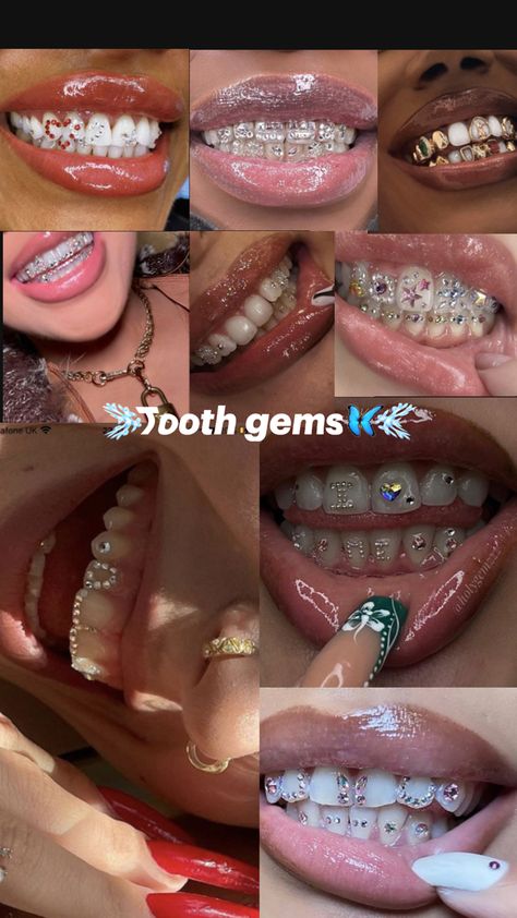 Tooth gems!🫧✨ Dental Accessories, Bijoux Piercing Septum, Making Beaded Jewelry, Walking On Eggshells, Pretty Teeth, Dental Jewelry, Grillz Teeth, Cute Braces, Diamond Teeth