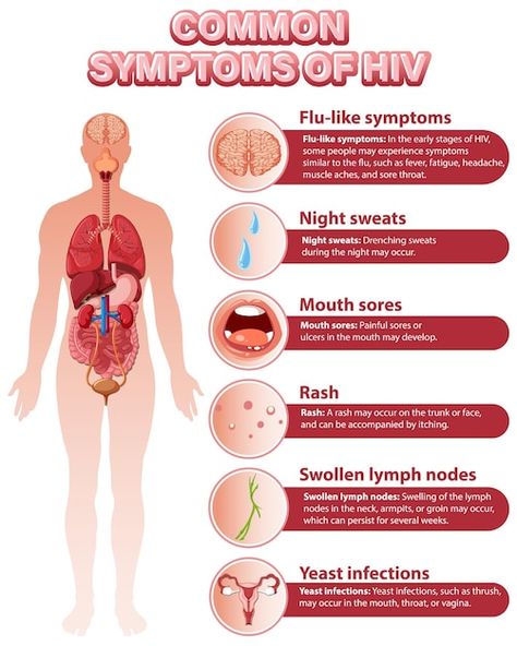 Informative poster of common symptoms of... | Free Vector #Freepik #freevector #physiology #anatomy #science-cartoon #human-anatomy Poster Hiv, Hiv Poster, Symptoms Of Hiv, Informative Poster, Hiv Symptoms, Anatomy Science, Cartoon Human, Human Anatomy, Anatomy