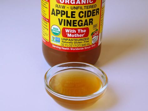 The 5 Stages of Candida Overgrowth - HubPages Diy Apple Cider Vinegar, Mosquito Trap Diy, Diy Apple Cider, Varicose Vein Remedy, Unfiltered Apple Cider Vinegar, Diy Apple, Candida Overgrowth, Mosquito Trap, Apple Cider Vinegar Drink