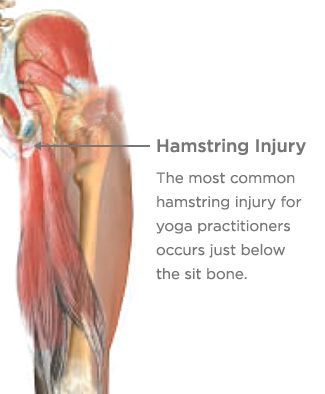 Dance Injuries, Torn Hamstring, Hamstring Exercises, Lower Back Injury, Hamstring Injury, Hamstring Muscles, Body Alignment, Hamstring Workout, Physical Therapy Exercises