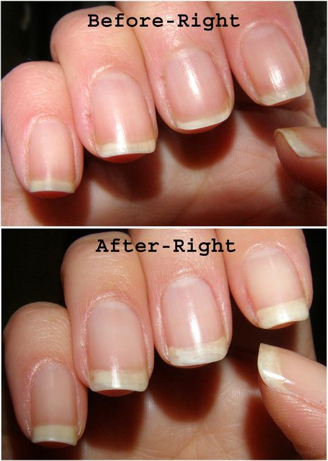 Nail Envy Before and After Nail Envy Opi, Opi Nail Envy, Natural Gel Nails, Nail Growth, Nail Envy, Makeup Tricks, Nail Strengthener, Opi Nails, Mani Pedi