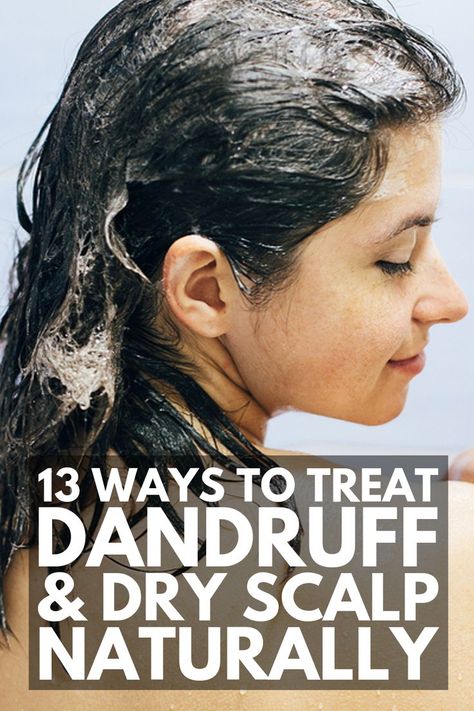 Dry Scalp Remedy, Baking Soda Coconut Oil, Home Remedies For Dandruff, Baking Soda Shampoo Recipe, Rid Of Dandruff, Natural Dry Shampoo, Dandruff Remedy, Getting Rid Of Dandruff, Flaking Skin