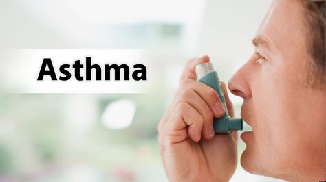 What is #asthma? What are the most common symptoms of asthma? #Asthma is a chronic disease that affects the airways of the lungs. During normal breathing, the bands of muscle that surround the airways are relaxed and air moves freely. During an asthma "attack," there are three main changes that stop air from moving easily through the airways: for more information.. Read this article post here: #clevelandclinic https://my.clevelandclinic.org/health/articles/asthma-an-overview Natural Asthma Remedies, Asthma Remedies, Asthma Relief, Asthma Inhaler, Asthma Symptoms, Asthma Attacks, Respiratory Diseases, Homeopathic Remedies, Ayurvedic Medicine