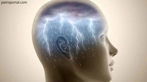 Thunderclap Headache - Location, Causes and Prevention - Pains Portal Headache Location, Whiplash Injury, Subarachnoid Hemorrhage, Bad Headache, Severe Headache, Migraine Headaches, Stomach Pain, Do Exercise, Blood Vessels