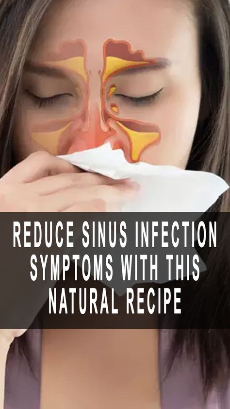 Reduce Sinus Infection Symptoms With This Natural Recipe Natural Remedies For Sinus Infection, Sinus Infection Remedy, Remedies For Sinus Infection, Sinus Infection Relief, Sinus Infection Symptoms, Sinus Congestion Relief, Sinus Infection Remedies, Natural Recipes, Congestion Relief