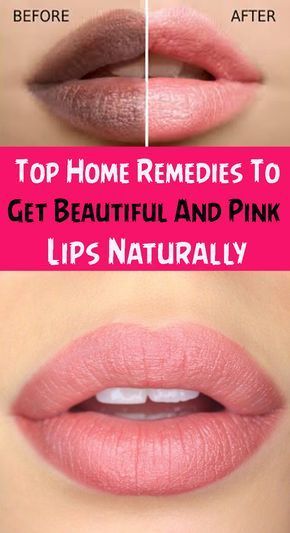 Get Baby Soft Pink Lips in just 1 Day Naturally at Home (Easy & 100% Works) Tips For Pink Lips, Get Pink Lips, Remedies For Dark Lips, Soft Pink Lips, Natural Pink Lips, Bright Pink Lips, Pink Lips Makeup, Lip Tips, Lip Care Routine