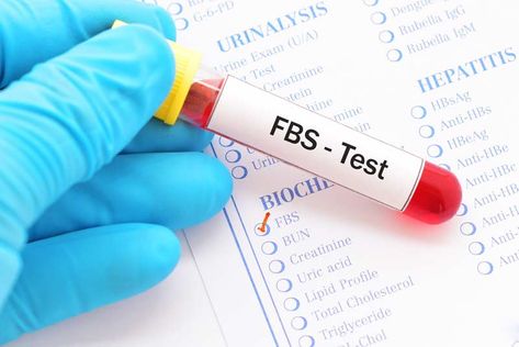 Blood Sugar Test, Lab Work, Lipid Profile, Blood Sugar Diet, Uric Acid, Blood Glucose Levels, Blood Test, Biochemistry, Blood Sugar Levels