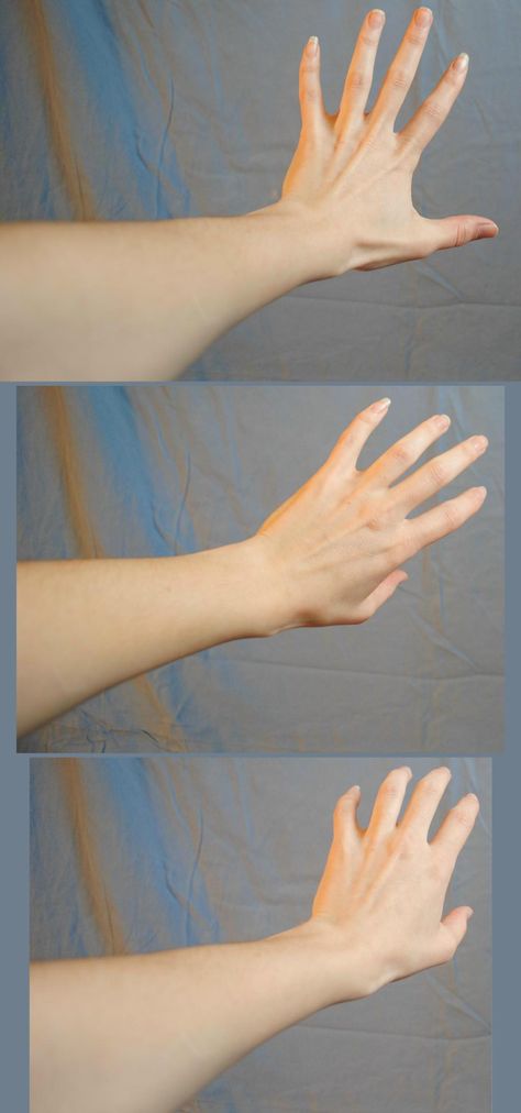 Arms Foreshortened Push by PirateLotus-Stock on DeviantArt Hand Anatomy, Hand Reference, Human Reference, Hand Pictures, Face Reference, My Journal, Anatomy Drawing, Body Reference, Anatomy Reference