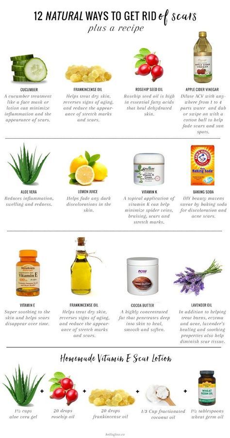 Natural scar treatments | DIY Natural Remedies Healing Cavities, Get Rid Of Scars, Getting Rid Of Scars, Scar Remedies, Natural Healing Remedies, Diy Remedies, Rosehip Seed Oil, Natural Cough Remedies, Cough Remedies