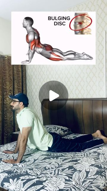 Dr Aqib Jamal on Instagram: "Reduce Disc Bulge & lower back pain with this exercise ✅

#disc #discbulge #discherniation #backpain #backpainrelief #sciatica #realign #draqibjamal" Slip Disc Exercises, Bulged Disc, Disc Exercises, Slip Disc, Bulging Disc, Disk Herniation, Lower Back Pain, Back Pain Relief, Sciatica