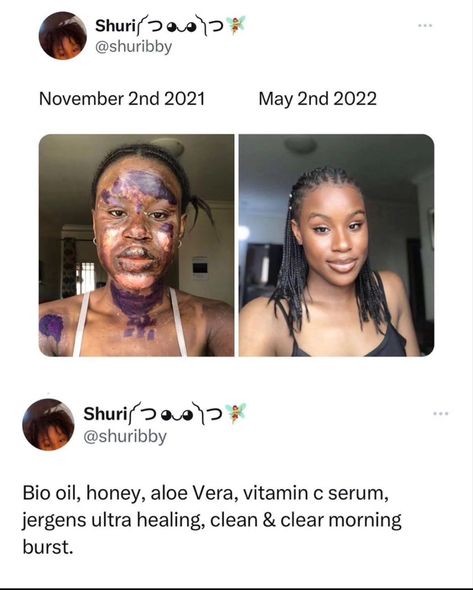 Natural Face Skin Care, Serious Skin Care, Good Skin Tips, Bio Oil, Perfect Skin Care Routine, Healthy Skin Tips, Skin Remedies, Body Care Routine, Future Ideas