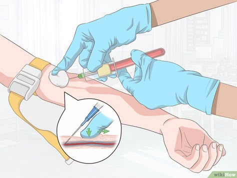 How to Draw Blood from Hard to Hit Veins: 15 Steps (with Pictures) How To Draw Blood, Phlebotomy Tips, Order Of Draw, Nurse Drawing, Nurse Teaching, Drawing Blood, Student Midwife, Family Nurse Practitioner, Medical Laboratory Science